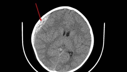 心碎!浙江2岁妹妹,3岁哥哥遇难…紧急提醒:不要去,不要去