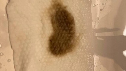 杭州部分小区居民反映自来水发臭，污染源仍不明